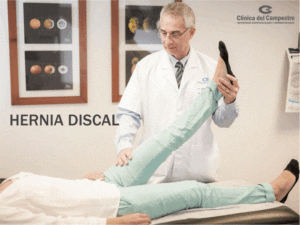 Hernia discal síntomas y tratamiento