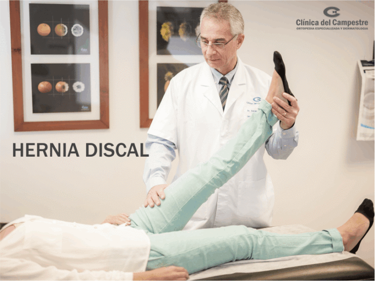 Hernia discal síntomas y tratamiento