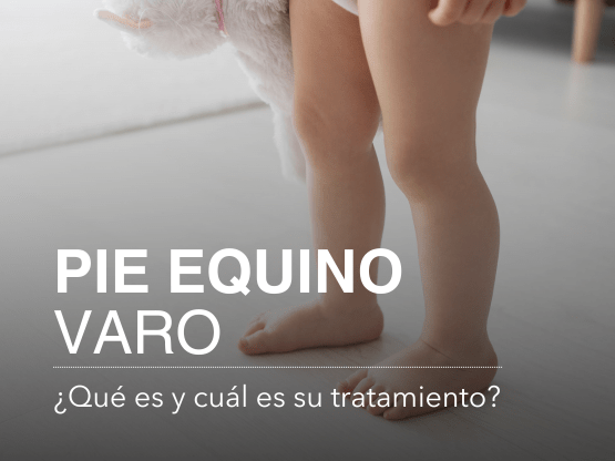 Qué es el pie equino varo